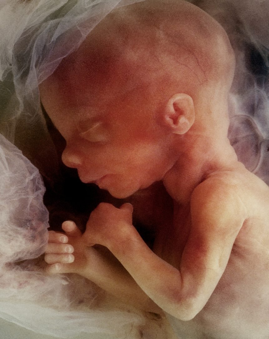 A new-born baby